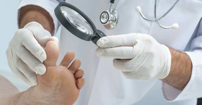 Kojų nagų diagnostinis tyrimas